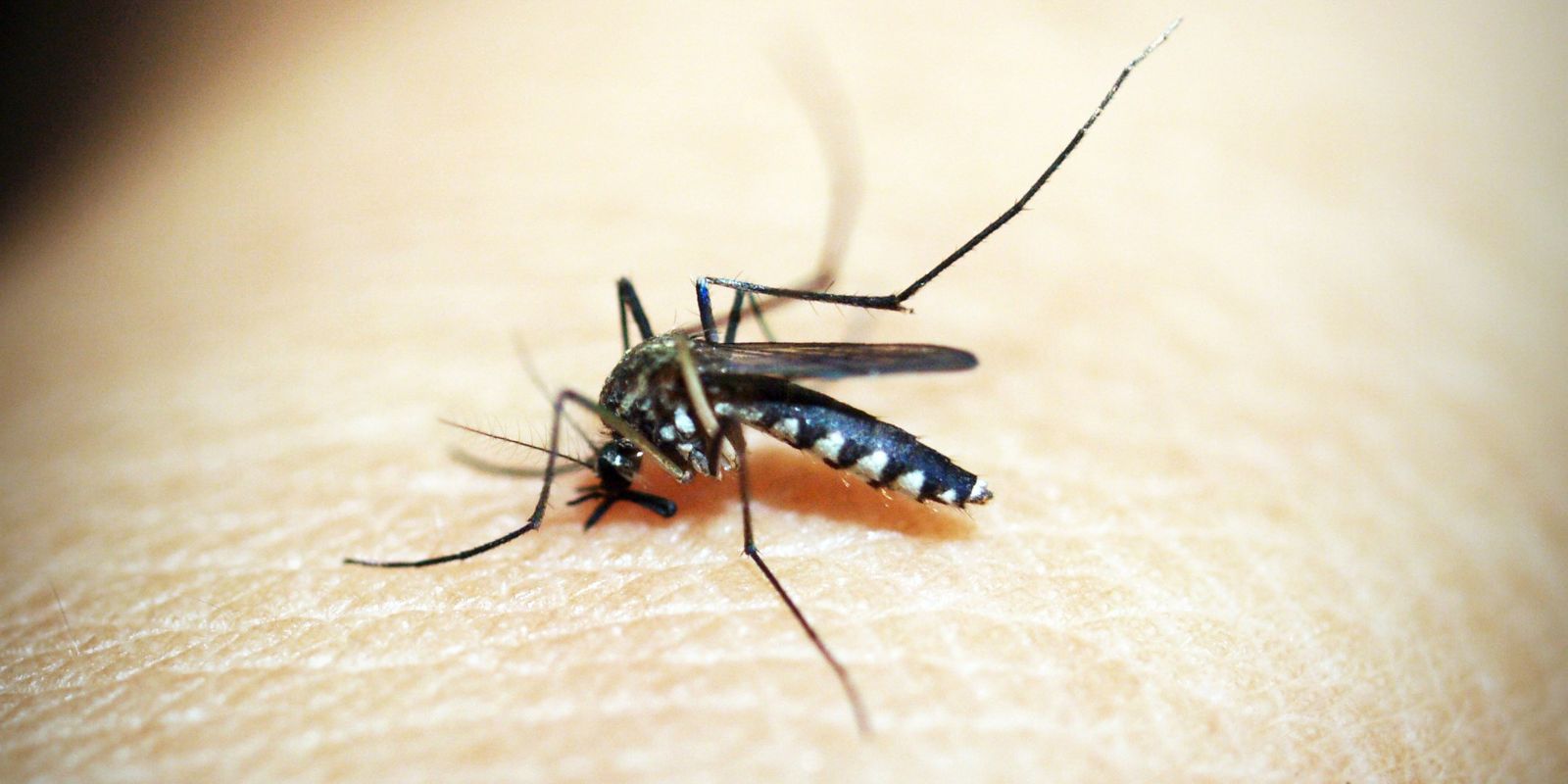 Brasileiros publicam maior estudo sobre sequelas do Zika 2 sequelas do Zika